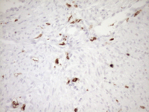 ITGAM / CD11b Antibody - Immunohistochemical staining of paraffin-embedded Human endometrium tissue within the normal limits using anti-ITGAM mouse monoclonal antibody. (Heat-induced epitope retrieval by 1mM EDTA in 10mM Tris buffer. (pH8.5) at 120°C for 3 min. (1:150)