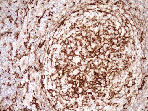 ITGAM / CD11b Antibody - Immunohistochemical staining of paraffin-embedded Human tonsil within the normal limits using anti-ITGAM mouse monoclonal antibody. (Heat-induced epitope retrieval by 1mM EDTA in 10mM Tris buffer. (pH8.5) at 120°C for 3 min. (1:150)