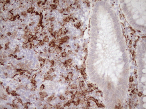ITGAM / CD11b Antibody - Immunohistochemical staining of paraffin-embedded Human colon tissue within the normal limits using anti-ITGAM mouse monoclonal antibody. (Heat-induced epitope retrieval by 1mM EDTA in 10mM Tris buffer. (pH8.5) at 120°C for 3 min. (1:150)