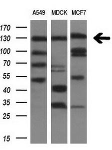 ITGAM / CD11b Antibody - Western blot analysis of extracts. (10ug) from 3 different cell lines by using anti-ITGAM monoclonal antibody. (1:200)