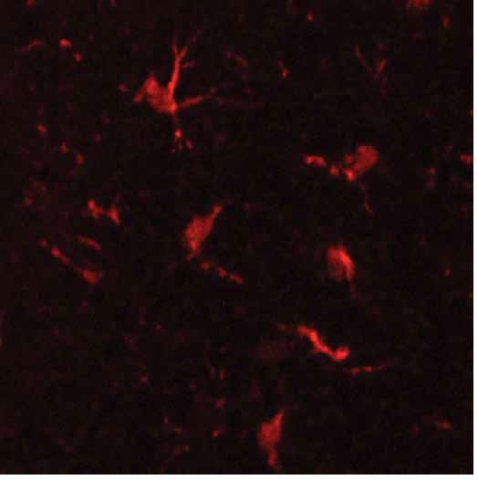 ITGAM / CD11b Antibody - Immunofluorescent staining of Integrin alpha M antibody. Mac-1 staining of microglial cells in mouse cerebral cortex (red). Photo courtesy of Dr. Felix Eckenstein, University of Vermont.