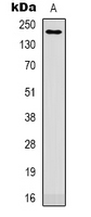 ITGAM / CD11b Antibody - Western blot analysis of CD11b expression in HEK293T (A) whole cell lysates.