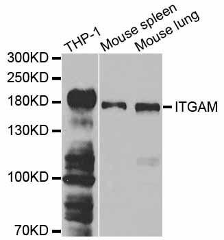 ITGAM / CD11b Antibody - Western blot analysis of extracts of various cell lines, using ITGAM antibody at 1:1000 dilution. The secondary antibody used was an HRP Goat Anti-Rabbit IgG (H+L) at 1:10000 dilution. Lysates were loaded 25ug per lane and 3% nonfat dry milk in TBST was used for blocking.