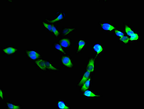 ITGAM / CD11b Antibody - Immunofluorescent analysis of Hela cells using ITGAM Antibody at a dilution of 1:100 and Alexa Fluor 488-congugated AffiniPure Goat Anti-Rabbit IgG(H+L)