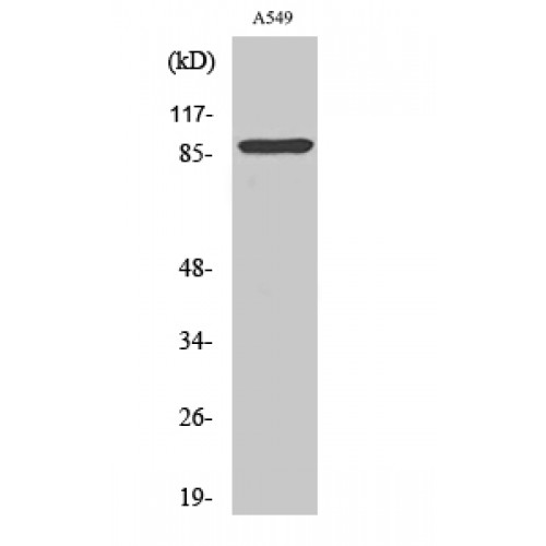 ITGAV/Integrin Alpha V/CD51 Antibody - Western blot of Cleaved-Integrin alphaV HC (K889) antibody