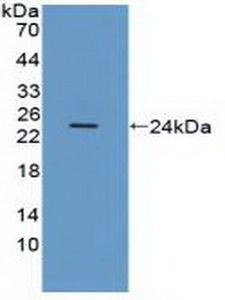 ITGAV/Integrin Alpha V/CD51 Antibody - Western Blot; Sample: Recombinant ITGaV, Human.