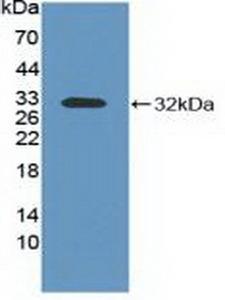 ITGAV/Integrin Alpha V/CD51 Antibody - Western Blot; Sample: Recombinant ITGaV, Mouse.