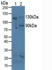 ITGAV/Integrin Alpha V/CD51 Antibody - Western Blot; Sample: Lane1: Human A549 Cells; Lane2: Human Hela Cells.