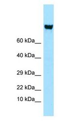 ITGAV/Integrin Alpha V/CD51 Antibody - ITGAV/Integrin Alpha V/CD51 antibody Western Blot of PANC1.  This image was taken for the unconjugated form of this product. Other forms have not been tested.