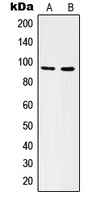 ITGAV/Integrin Alpha V/CD51 Antibody - Western blot analysis of CD51 HC expression in A549 (A); C6 (B) whole cell lysates.