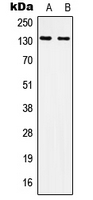 ITGAV/Integrin Alpha V/CD51 Antibody - Western blot analysis of CD51 expression in A549 (A); HepG2 (B) whole cell lysates.