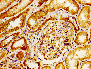 ITGAV/Integrin Alpha V/CD51 Antibody - Immunohistochemistry image of paraffin-embedded human kidney tissue at a dilution of 1:100