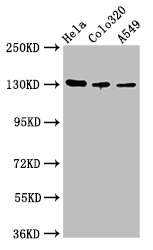 ITGAV/Integrin Alpha V/CD51 Antibody - Positive Western Blot detected in Hela whole cell lysate, Colo320 whole cell lysate, A549 whole cell lysate. All lanes: ITGAV antibody at 2.7 µg/ml Secondary Goat polyclonal to rabbit IgG at 1/50000 dilution. Predicted band size: 117, 113, 112 KDa. Observed band size: 130 KDa