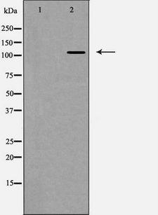 ITGAV/Integrin Alpha V/CD51 Antibody - Western blot analysis of Integrin aV expression in HeLa cells. The lane on the left is treated with the antigen-specific peptide.