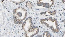 ITGAV/Integrin Alpha V/CD51 Antibody - 1:100 staining human prostate tissue by IHC-P. The sample was formaldehyde fixed and a heat mediated antigen retrieval step in citrate buffer was performed. The sample was then blocked and incubated with the antibody for 1.5 hours at 22°C. An HRP conjugated goat anti-rabbit antibody was used as the secondary.