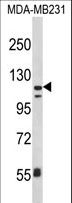 ITGAX / CD11c Antibody - Western blot of ITGAX Antibody in MDA-MB231 cell line lysates (35 ug/lane). ITGAX (arrow) was detected using the purified antibody.