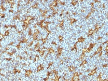 ITGAX / CD11c Antibody - IHC testing of human tonsil with CD11c antibody (clone ITGAX/1242). Note specific staining of dendritic cells. Required HIER: boil tissue sections in 10mM Tris with 1mM EDTA, pH 9, for 10-20 min.