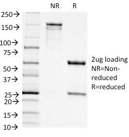 ITGAX / CD11c Antibody - SDS-PAGE Analysis of Purified, BSA-Free CD11c Antibody (clone ITGAX/1242). Confirmation of Integrity and Purity of the Antibody.