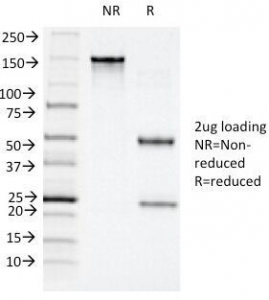 ITGAX / CD11c Antibody - SDS-PAGE Analysis of Purified, BSA-Free CD11c Antibody (clone ITGAX/1243). Confirmation of Integrity and Purity of the Antibody.