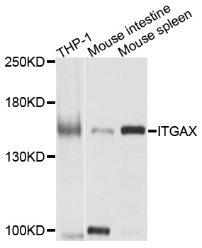 ITGAX / CD11c Antibody - Western blot analysis of extracts of various cell lines, using ITGAX antibody at 1:1000 dilution. The secondary antibody used was an HRP Goat Anti-Rabbit IgG (H+L) at 1:10000 dilution. Lysates were loaded 25ug per lane and 3% nonfat dry milk in TBST was used for blocking. An ECL Kit was used for detection and the exposure time was 5s.