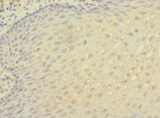 ITGAX / CD11c Antibody - Immunohistochemistry of paraffin-embedded human tonsil tissue at dilution 1:100