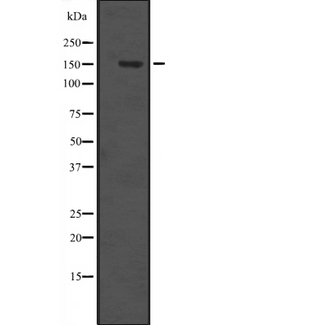 ITGAX / CD11c Antibody - Western blot analysis of ITGAX expression in Ant TPA lysate. The lane on the left is treated with the antigen-specific peptide.