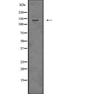 ITGAX / CD11c Antibody - Western blot analysis CD11c using HeLa whole cells lysates