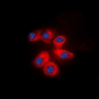 ITGB1 / Integrin Beta 1 / CD29 Antibody - Immunofluorescent analysis of CD29 staining in NIH3T3 cells. Formalin-fixed cells were permeabilized with 0.1% Triton X-100 in TBS for 5-10 minutes and blocked with 3% BSA-PBS for 30 minutes at room temperature. Cells were probed with the primary antibody in 3% BSA-PBS and incubated overnight at 4 deg C in a humidified chamber. Cells were washed with PBST and incubated with a DyLight 594-conjugated secondary antibody (red) in PBS at room temperature in the dark. DAPI was used to stain the cell nuclei (blue).