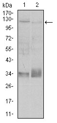 ITGB1 / Integrin Beta 1 / CD29 Antibody - Western blot using ITGB1 mouse monoclonal antibody against A549 (1), and Jurkat (2) cell lysate.