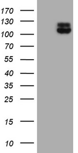 ITGB1 / Integrin Beta 1 / CD29 Antibody - HEK293T cells were transfected with the pCMV6-ENTRY control. (Left lane) or pCMV6-ENTRY ITGB1. (Right lane) cDNA for 48 hrs and lysed. Equivalent amounts of cell lysates. (5 ug per lane) were separated by SDS-PAGE and immunoblotted with anti-ITGB1. (1:500)