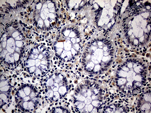 ITGB1 / Integrin Beta 1 / CD29 Antibody - Immunohistochemical staining of paraffin-embedded Human colon tissue within the normal limits using anti-ITGB1 mouse monoclonal antibody. (Heat-induced epitope retrieval by 1mM EDTA in 10mM Tris buffer. (pH8.5) at 120°C for 3 min. (1:150)