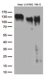 ITGB1 / Integrin Beta 1 / CD29 Antibody - Western blot analysis of extracts. (35ug) from 3 different cell lines by using anti-ITGB1 monoclonal antibody. (1:500)