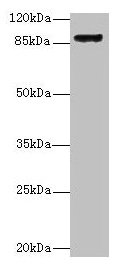 ITGB1 / Integrin Beta 1 / CD29 Antibody - Western blot All lanes: ITGB1 antibody at 16µg/ml + U87 whole cell lysate Secondary Goat polyclonal to rabbit IgG at 1/10000 dilution Predicted band size: 88 kDa Observed band size: 88 kDa