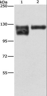 ITGB1 / Integrin Beta 1 / CD29 Antibody - Western blot analysis of A172 cell and human leiomyosarcoma tissue, using ITGB1 Polyclonal Antibody at dilution of 1:600.