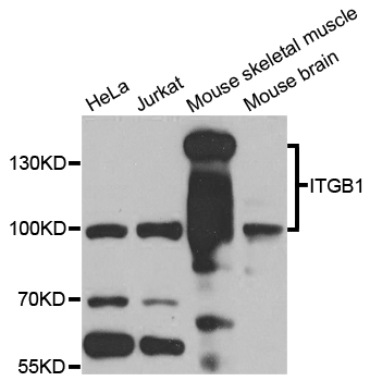 ITGB1 / Integrin Beta 1 / CD29 Antibody - Western blot analysis of extracts of various cell lines.