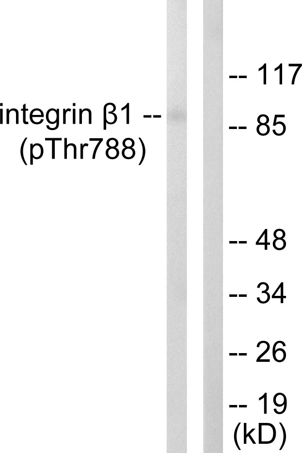 ITGB1 / Integrin Beta 1 / CD29 Antibody - Western blot analysis of lysates from HeLa cells treated with UV 15', using Integrin beta1 (Phospho-Thr788) Antibody. The lane on the right is blocked with the phospho peptide.