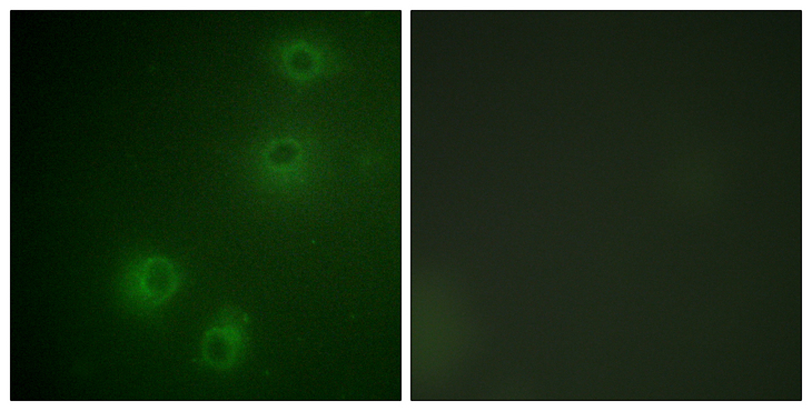 ITGB1 / Integrin Beta 1 / CD29 Antibody - Immunofluorescence analysis of COS7 cells, using Integrin beta1 (Phospho-Thr789) Antibody. The picture on the right is blocked with the phospho peptide.