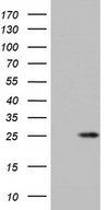 ITGB1BP1 / ICAP1 Antibody - HEK293T cells were transfected with the pCMV6-ENTRY control (Left lane) or pCMV6-ENTRY ITGB1BP1 (Right lane) cDNA for 48 hrs and lysed. Equivalent amounts of cell lysates (5 ug per lane) were separated by SDS-PAGE and immunoblotted with anti-ITGB1BP1.