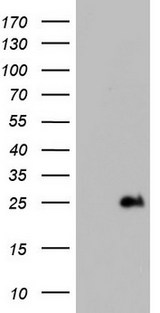 ITGB1BP1 / ICAP1 Antibody - HEK293T cells were transfected with the pCMV6-ENTRY control (Left lane) or pCMV6-ENTRY ITGB1BP1 (Right lane) cDNA for 48 hrs and lysed. Equivalent amounts of cell lysates (5 ug per lane) were separated by SDS-PAGE and immunoblotted with anti-ITGB1BP1.