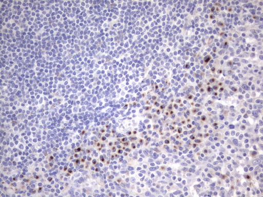 ITGB1BP1 / ICAP1 Antibody - IHC of paraffin-embedded Human tonsil using anti-ITGB1BP1 mouse monoclonal antibody. (Heat-induced epitope retrieval by 1 mM EDTA in 10mM Tris, pH8.5, 120°C for 3min).