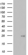 ITGB1BP1 / ICAP1 Antibody - HEK293T cells were transfected with the pCMV6-ENTRY control (Left lane) or pCMV6-ENTRY ITGB1BP1 (Right lane) cDNA for 48 hrs and lysed. Equivalent amounts of cell lysates (5 ug per lane) were separated by SDS-PAGE and immunoblotted with anti-ITGB1BP1.