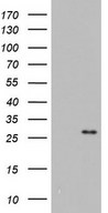 ITGB1BP1 / ICAP1 Antibody - HEK293T cells were transfected with the pCMV6-ENTRY control (Left lane) or pCMV6-ENTRY ITGB1BP1 (Right lane) cDNA for 48 hrs and lysed. Equivalent amounts of cell lysates (5 ug per lane) were separated by SDS-PAGE and immunoblotted with anti-ITGB1BP1.