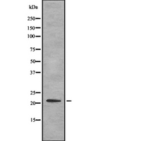 ITGB1BP1 / ICAP1 Antibody - Western blot analysis of ITBP1 expression in HEK293 cells. The lane on the left is treated with the antigen-specific peptide.