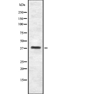ITGB1BP2 / MELUSIN Antibody - Western blot analysis ITBP2 using Jurkat whole cells lysates