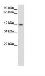 ITGB1BP2 / MELUSIN Antibody - Fetal Heart Lysate.  This image was taken for the unconjugated form of this product. Other forms have not been tested.