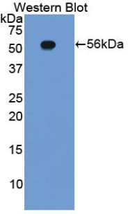 ITGB2 / CD18 Antibody - Western blot of recombinant ITGB2 / MAC-1 / CD18.  This image was taken for the unconjugated form of this product. Other forms have not been tested.