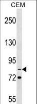 ITGB2 / CD18 Antibody - ITGB2 Antibody western blot of CEM cell line lysates (35 ug/lane). The ITGB2 antibody detected the ITGB2 protein (arrow).