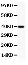 ITGB2 / CD18 Antibody - CD18 antibody Western blot. All lanes: Anti CD18 at 0.5 ug/ml. WB: Recombinant Human CD18 Protein 0.5ng. Predicted band size: 40 kD. Observed band size: 40 kD.
