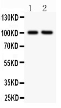 ITGB2 / CD18 Antibody - CD18 antibody Western blot. All lanes: Anti CD18 at 0.5 ug/ml. Lane 1: JURKAT Whole Cell Lysate at 40 ug. Lane 2: CEM Whole Cell Lysate at 40 ug. Predicted band size: 85 kD . Observed band size: 100 kD.