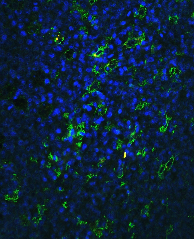 ITGB2 / CD18 Antibody - IF analysis of CD18 using anti-CD18 antibody. CD18 was detected in paraffin-embedded section of human tonsil tissue. Heat mediated antigen retrieval was performed in citrate buffer (pH6, epitope retrieval solution) for 20 mins. The tissue section was blocked with 10% goat serum. The tissue section was then incubated with 1µg/ml rabbit anti-CD18 Antibody overnight at 4°C. DyLight®488 Conjugated Goat Anti-Rabbit IgG was used as secondary antibody at 1:100 dilution and incubated for 30 minutes at 37°C. The section was counterstained with DAPI. Visualize using a fluorescence microscope and filter sets appropriate for the label used.